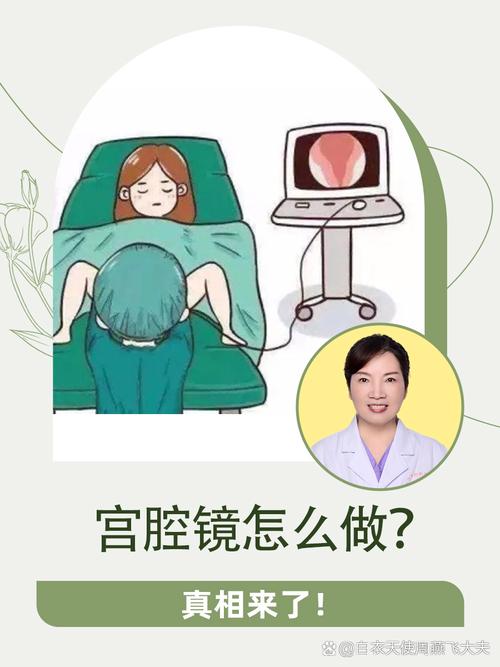 人流后月经变少该做宫腔镜吗