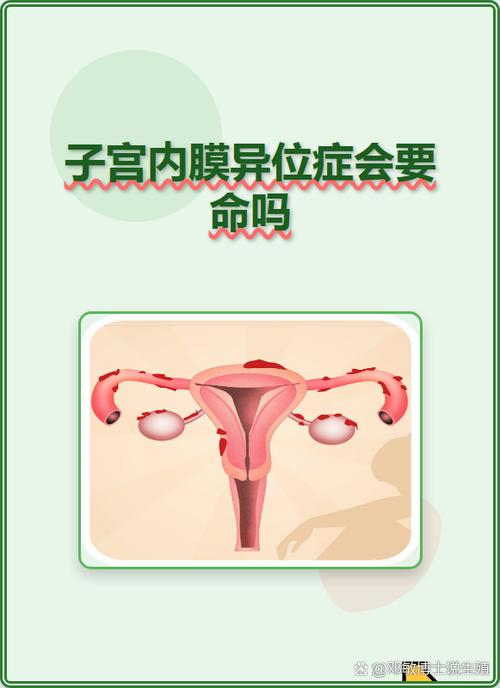 深部内异症影响怀孕吗