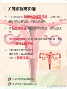 深部内异症影响怀孕吗?答案和办法都在这-两性知识丨两性健康--你想了解的我都知道