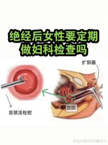 妇科检查能要求第三方回避吗?-两性知识丨两性健康--你想了解的我都知道