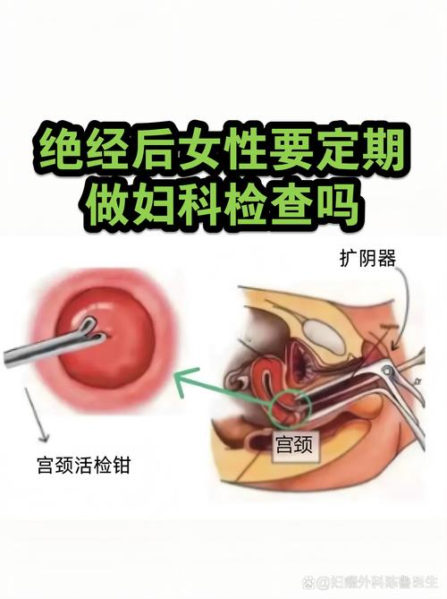 妇科检查能要求第三方回避吗