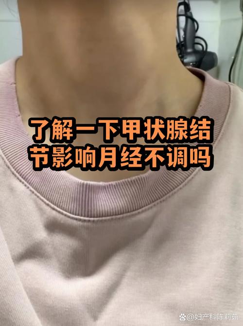 甲状腺结节会影响月经吗