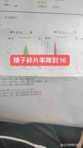 精子碎片率偏高，自然受孕的机会其实比你想象的大-两性知识丨两性健康--你想了解的我都知道