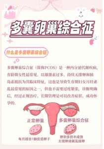 多囊长期不来月经,子宫正悄悄承受这些伤害-两性知识丨两性健康--你想了解的我都知道