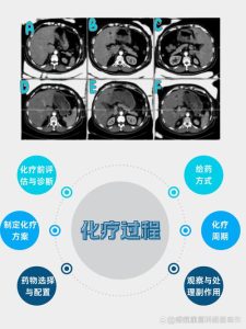 癌症患者化疗前怎么保住生育力-两性知识丨两性健康--你想了解的我都知道