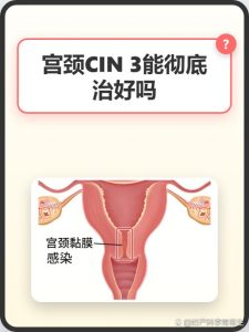 宫颈病变治疗后要避孕吗？-两性知识丨两性健康--你想了解的我都知道