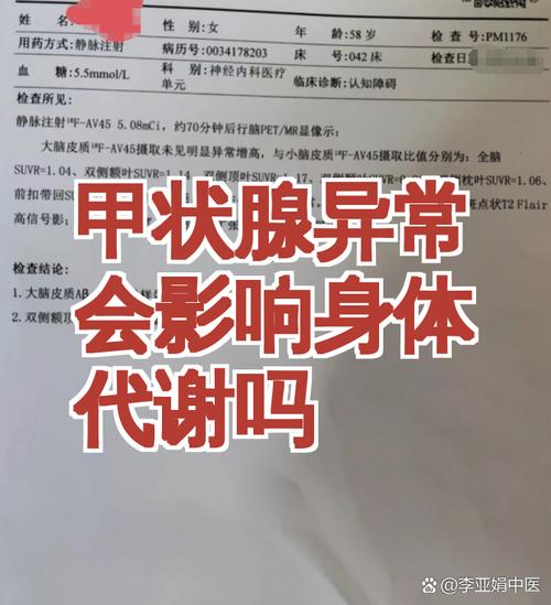 甲状腺和代谢异常会一起出现吗