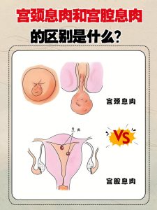 性欲低和子宫内膜息肉有关吗-两性知识丨两性健康--你想了解的我都知道