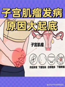 痛经和子宫肌瘤有关吗?一文帮你搞清楚!-两性知识丨两性健康--你想了解的我都知道