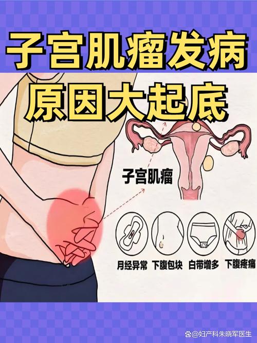 痛经和子宫肌瘤有关吗