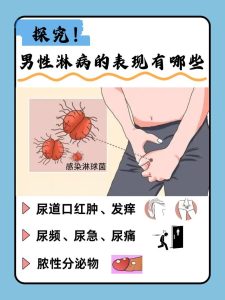 淋病感染史会影响性欲吗？-两性知识丨两性健康--你想了解的我都知道