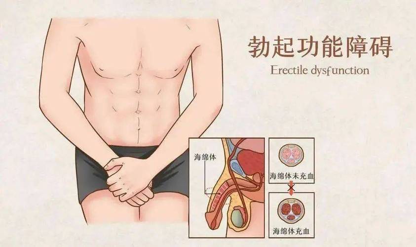 勃起功能受血管和神经影响吗