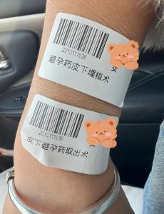 皮下埋植到期取出麻烦吗-两性知识丨两性健康--你想了解的我都知道