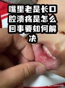 性欲低和口腔溃疡反复有关吗-两性知识丨两性健康--你想了解的我都知道
