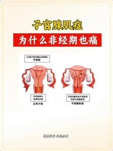 性欲低和子宫腺肌症有关吗？一文给你讲明白-两性知识丨两性健康--你想了解的我都知道