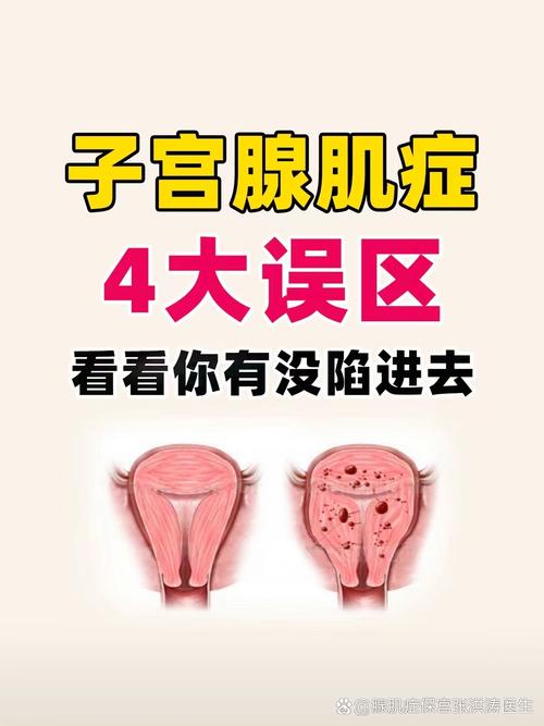 性欲低和子宫腺肌症有关吗