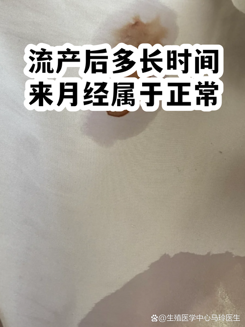 流产后多久来月经算正常