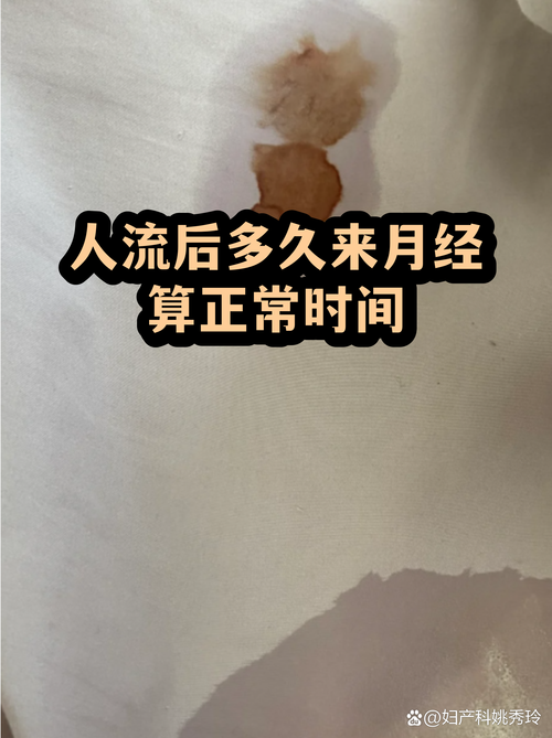 流产后多久来月经算正常