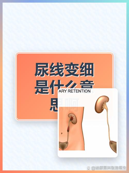 排尿变细和增生有关系吗-相关配图