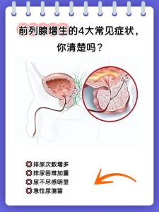 排尿变细多半是增生在“挤管子”，但别急着给自己下诊断-两性知识丨两性健康--你想了解的我都知道