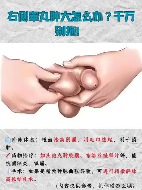 睾丸肿块要马上就医吗