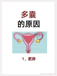 多囊和代谢异常为什么常并存-两性知识丨两性健康--你想了解的我都知道