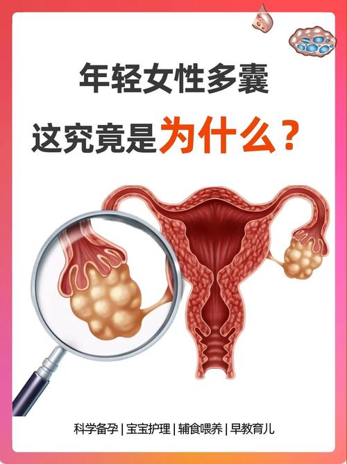 多囊和代谢异常为什么常并存-相关配图
