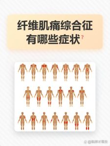 性欲低和纤维肌痛有关吗?-两性知识丨两性健康--你想了解的我都知道