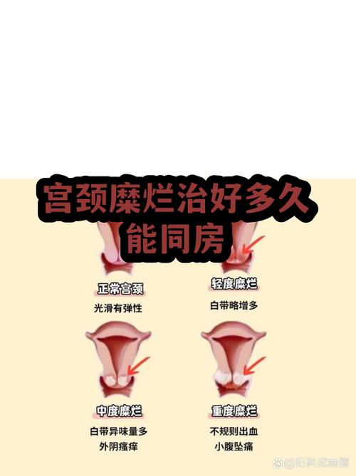 宫颈病变治疗后要禁同房多久