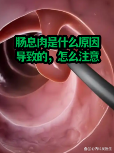 性欲低和肠道息肉有关吗-两性知识丨两性健康--你想了解的我都知道