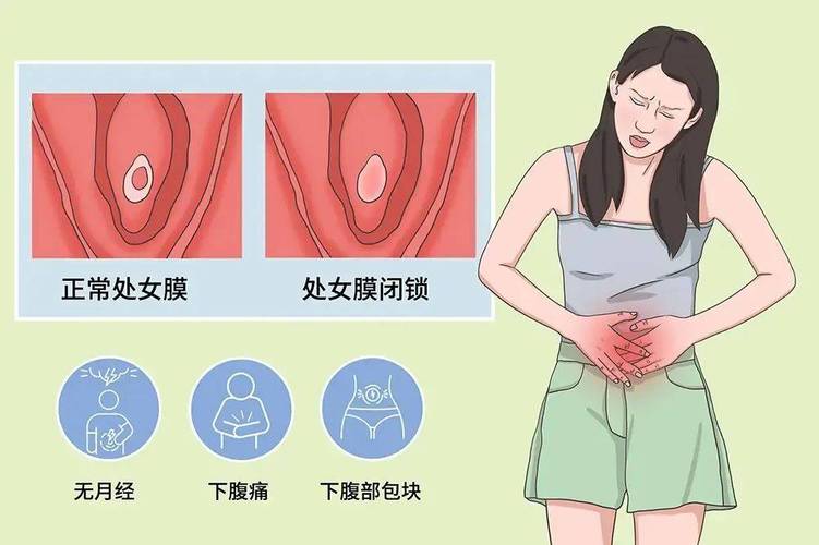 阴道痉挛和心理因素有关吗