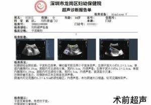 痛经越来越重，真的需要做B超吗？-两性知识丨两性健康--你想了解的我都知道