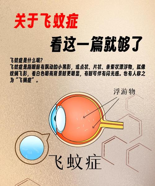 性欲低和飞蚊症有关吗-示意图