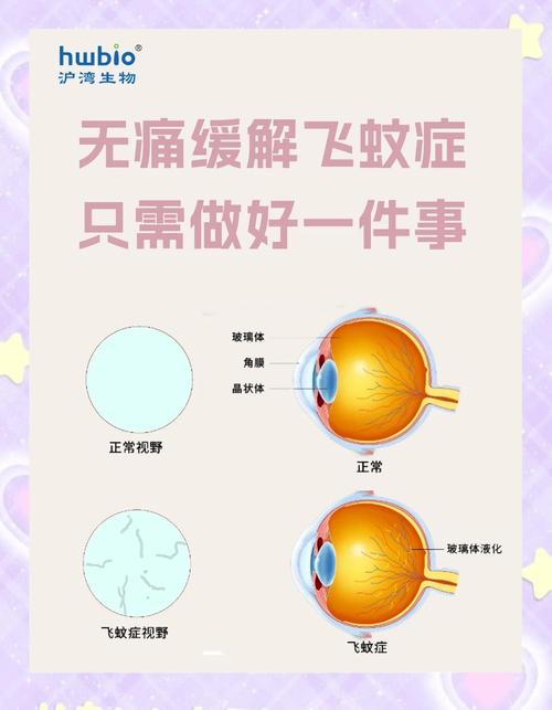 性欲低和飞蚊症有关吗-相关配图