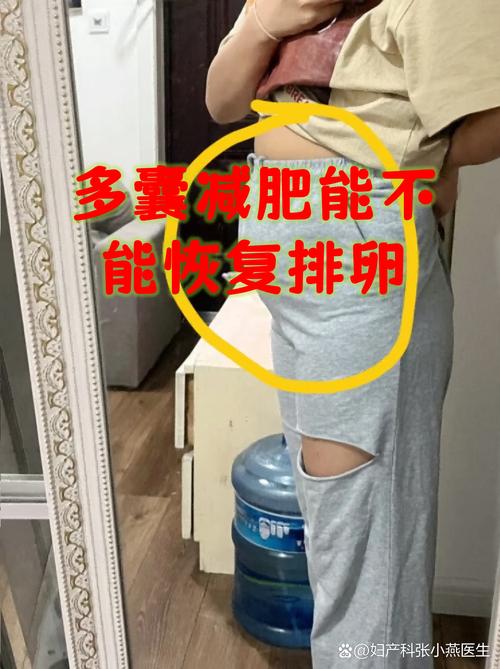 多囊患者减重多少能恢复排卵