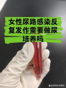 尿路感染反复要做尿培养吗-两性知识丨两性健康--你想了解的我都知道