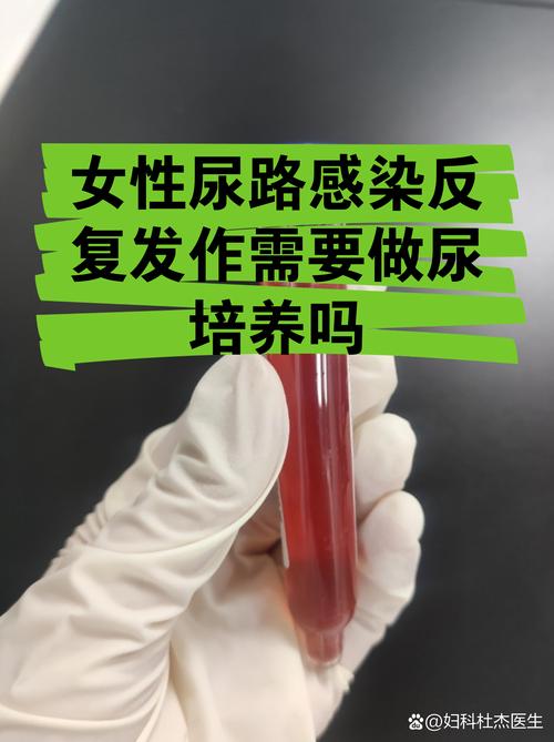 尿路感染反复要做尿培养吗