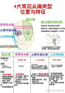 性欲低和偏头痛有关吗?-两性知识丨两性健康--你想了解的我都知道