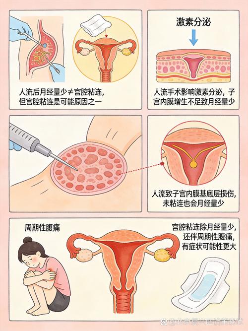 人流后月经量减少是粘连吗