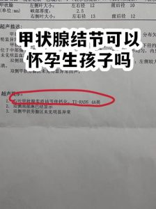查出甲状腺结节会影响备孕吗-两性知识丨两性健康--你想了解的我都知道