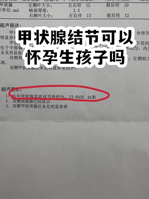 查出甲状腺结节会影响备孕吗-示意图