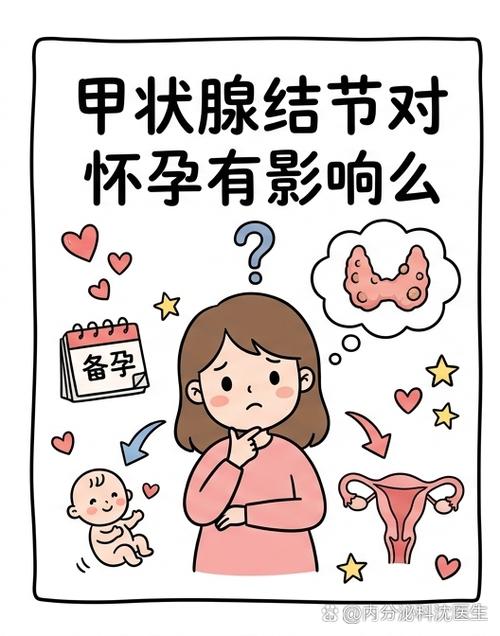 查出甲状腺结节会影响备孕吗-相关配图