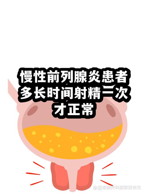 排精次数多一些对前列腺好吗-示意图