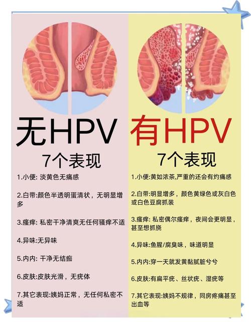 夫妻双方都感染HPV如何随访