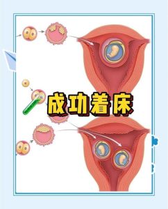 乳酸杆菌和胚胎着床有关吗-两性知识丨两性健康--你想了解的我都知道