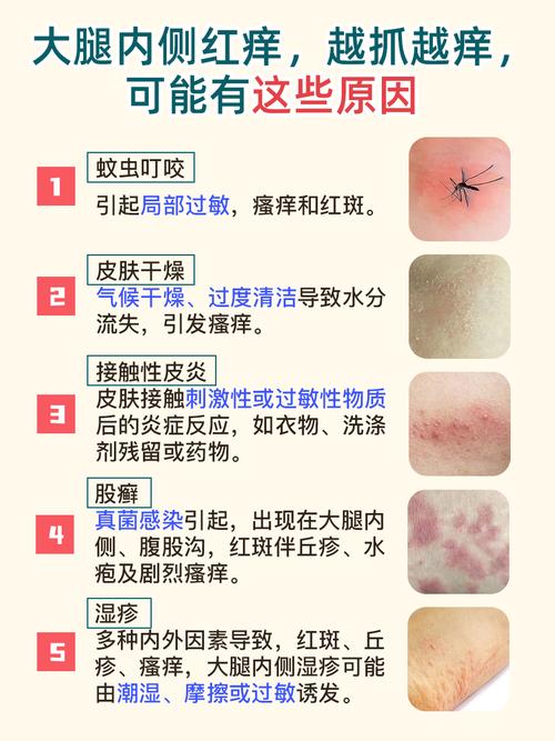 性欲低和过敏体质有关吗