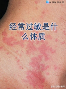 性欲低和过敏体质有关吗-两性知识丨两性健康--你想了解的我都知道