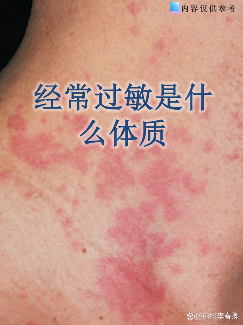 性欲低和过敏体质有关吗