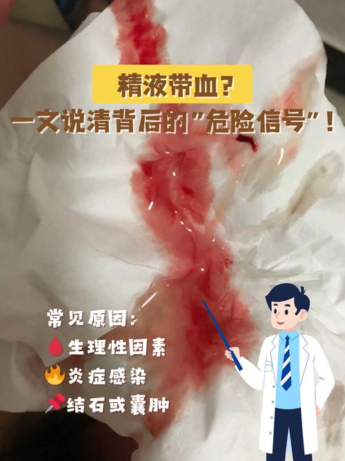 性欲低和血精现象有关吗