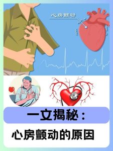 性欲低和心房颤动有关吗-两性知识丨两性健康--你想了解的我都知道